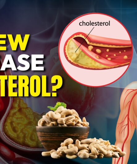 Do Cashews Affect Cholesterol Levels? Discover the Answer!